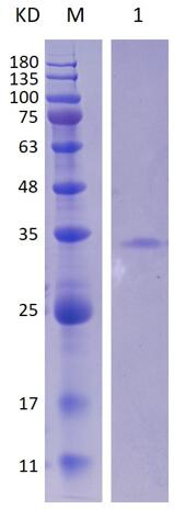 15% SDS-PAGE analysis profiles of purified MCR_RS03775-24-157 (CBB stained).